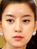 Yoon-so Choi