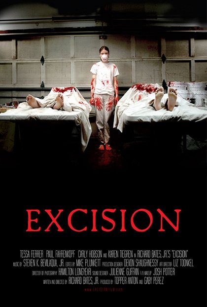Excision